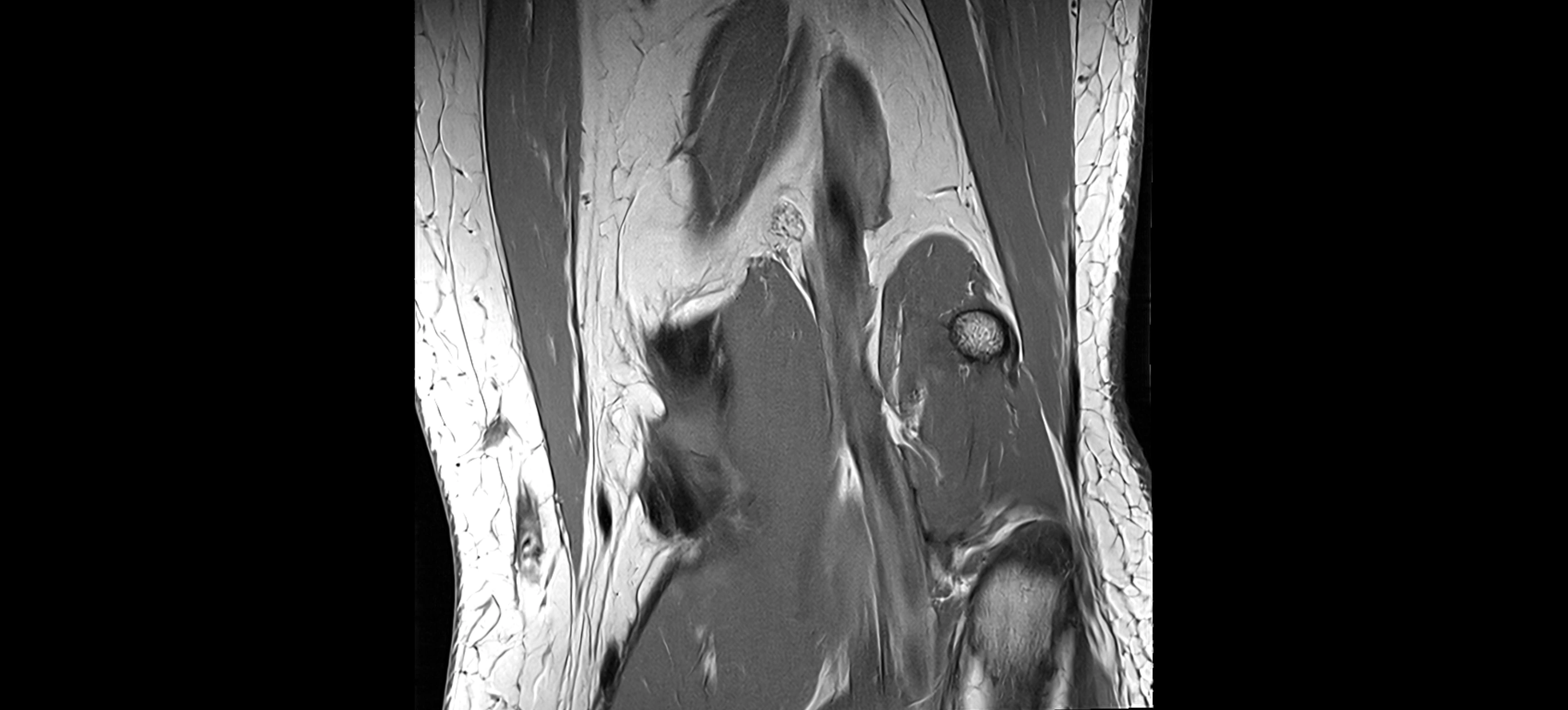 MRI coronal  ligaments cross sectional anatomy 3T  radiology  image-img-04001-00031.webp